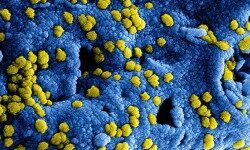 coronavirus